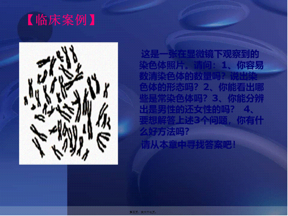 人类染色体与染色体病解读.pptx_第3页