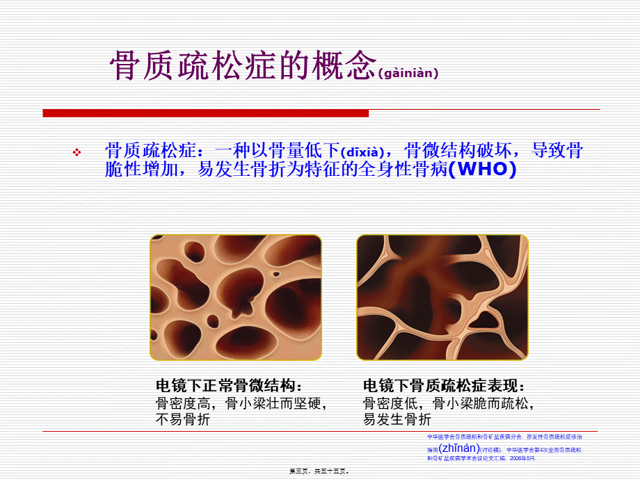 2022年医学专题—糖皮质激素性骨质疏松症的诊治进展(GIO(1).ppt_第3页