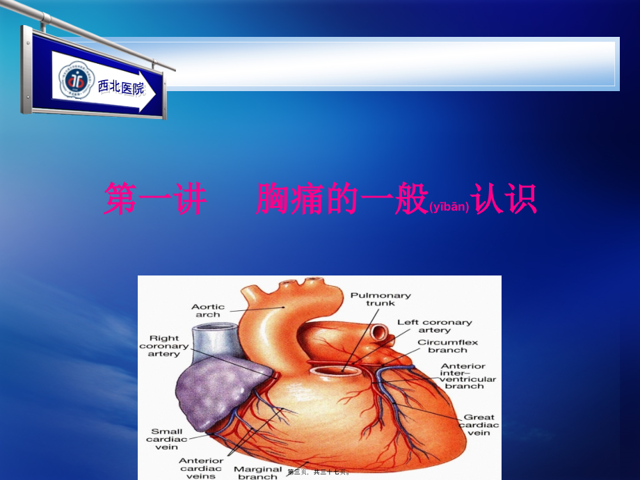 2022年医学专题—唐城医院心绞痛.ppt_第3页