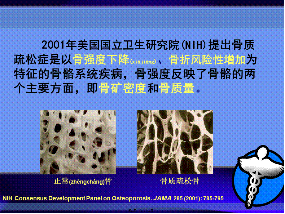 2022年医学专题—糖皮质激素所致骨质疏松症.ppt_第2页