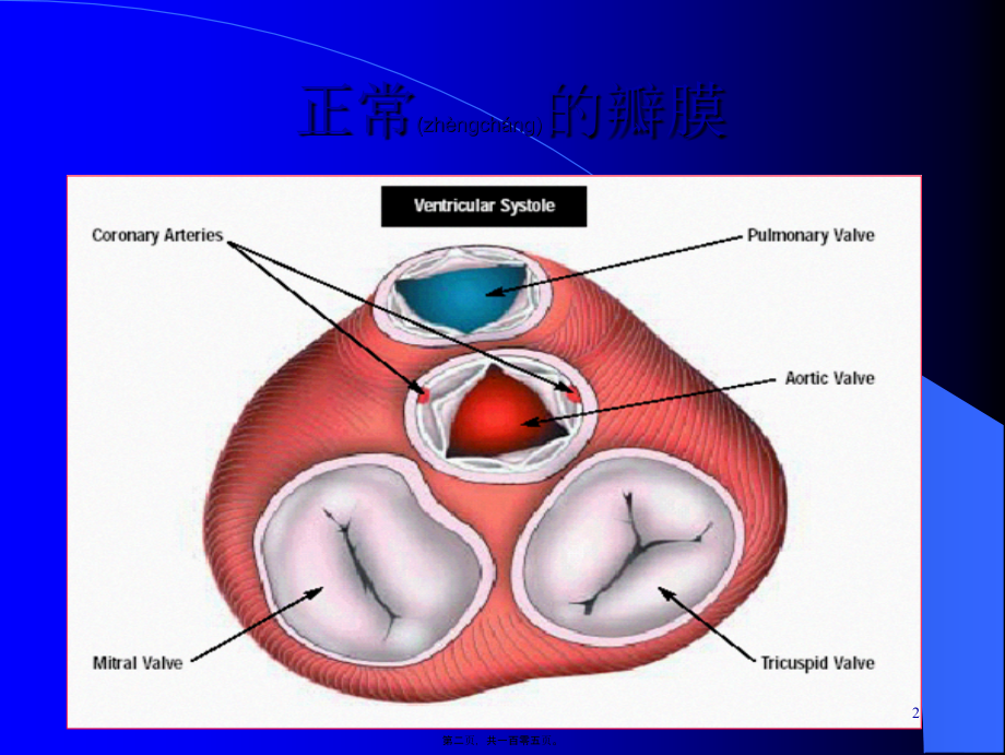 2022年医学专题—心脏瓣膜病-精品.ppt_第2页