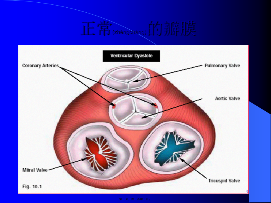 2022年医学专题—心脏瓣膜病-精品.ppt_第3页
