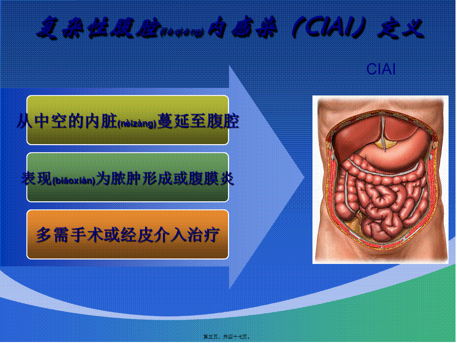 2022年医学专题—感染(1).ppt_第3页