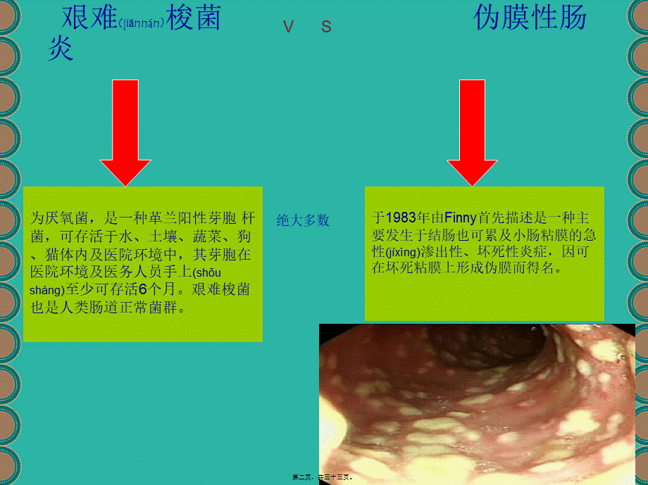 2022年医学专题—抗生素相关性艰难梭菌伪膜性肠炎(1).ppt_第2页