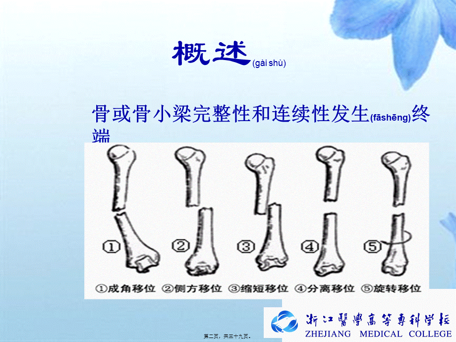 2022年医学专题—4胫腓骨干骨折(1).ppt_第2页