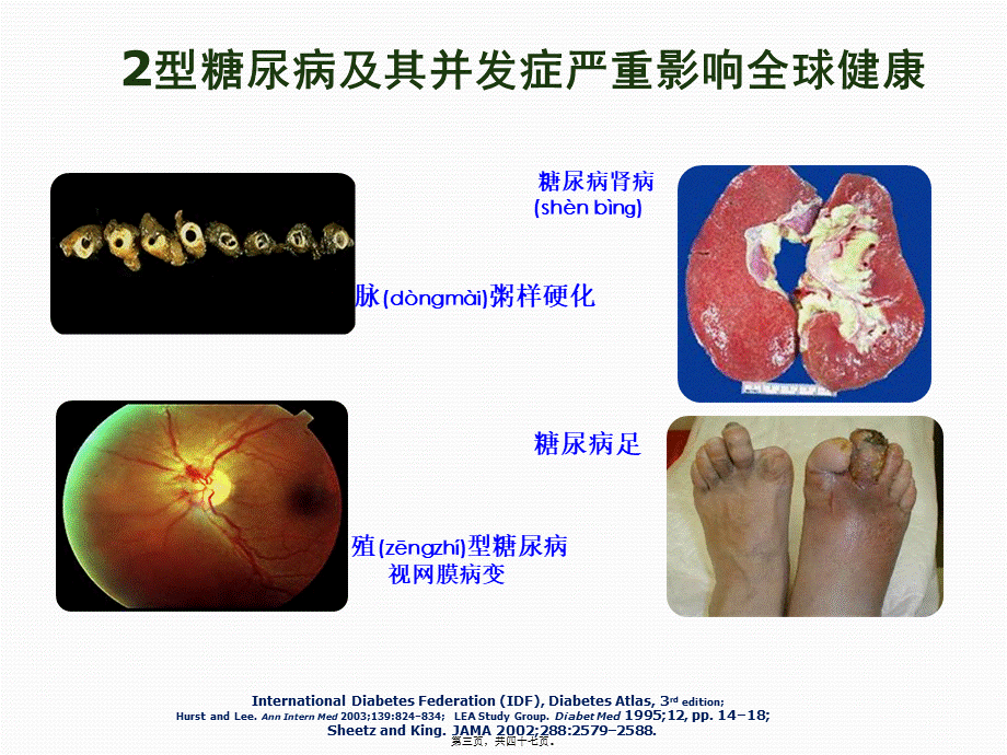 2022年医学专题—胰岛素分类及特点(1).pptx_第3页