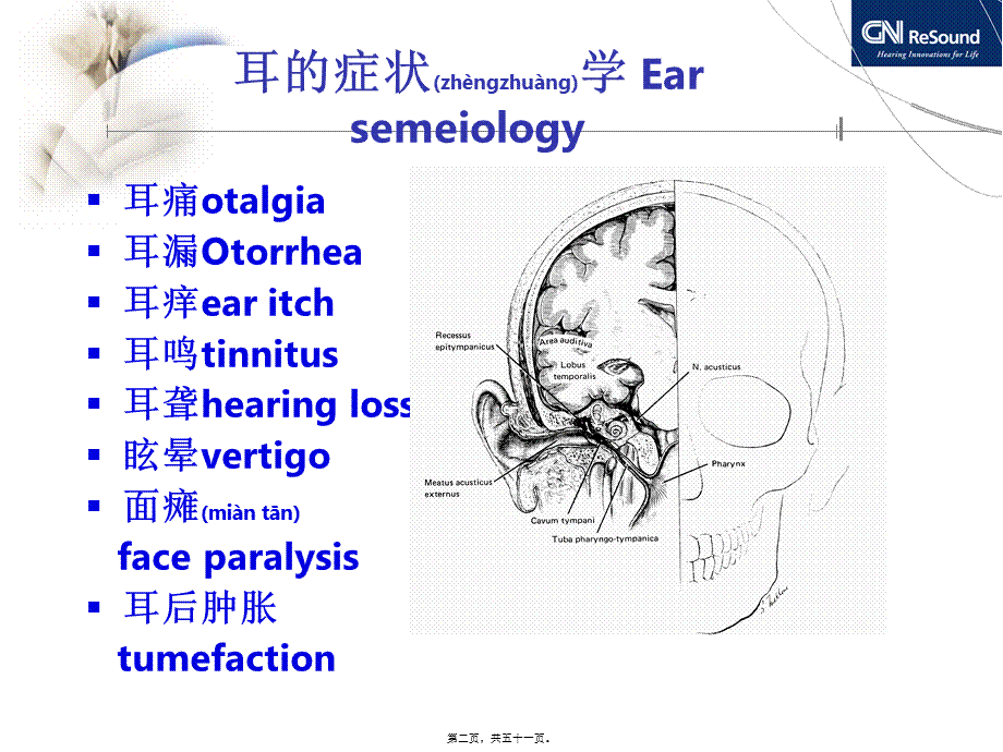 2022年医学专题—耳聋与耳鸣的关系讲诉.ppt_第2页