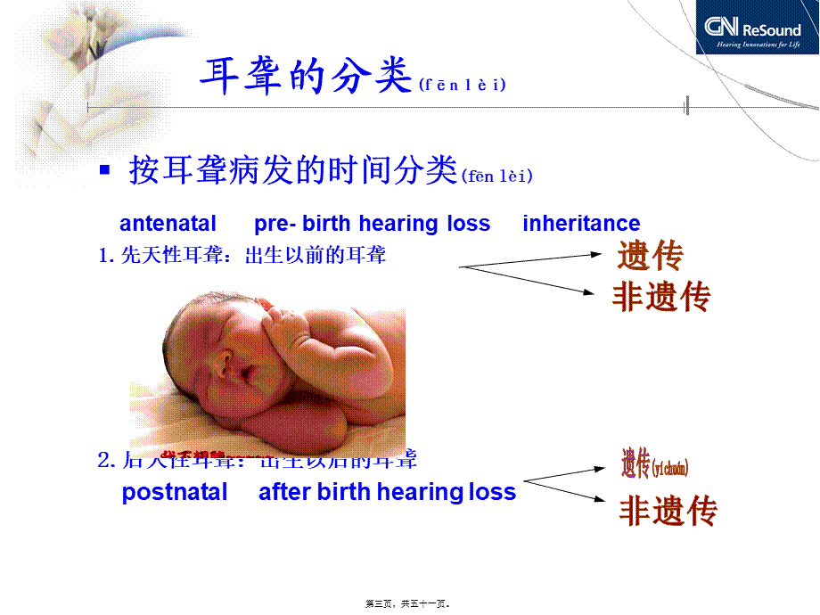 2022年医学专题—耳聋与耳鸣的关系讲诉.ppt_第3页