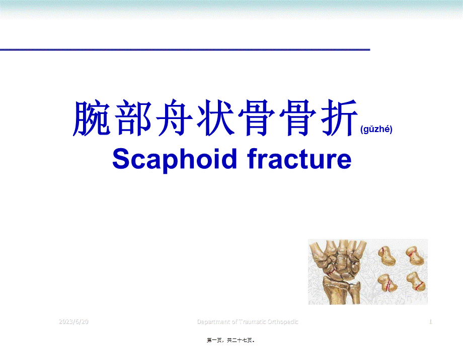 2022年医学专题—腕部舟状骨骨折(1).ppt_第1页