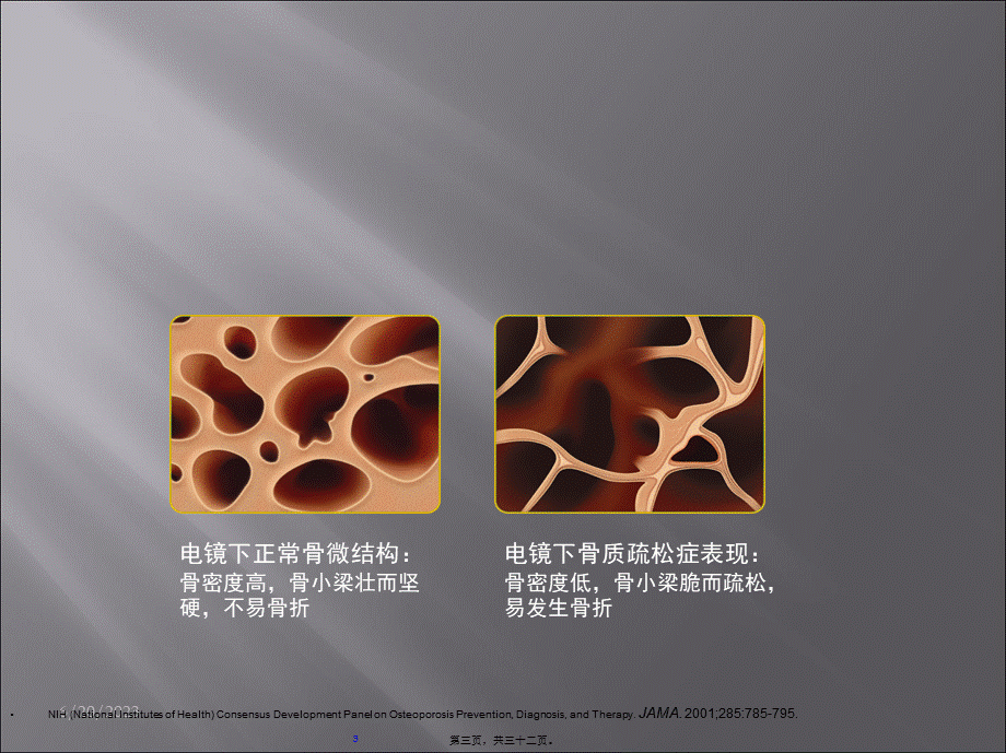 2022年医学专题—COPD合并骨质疏松症(1).ppt_第3页