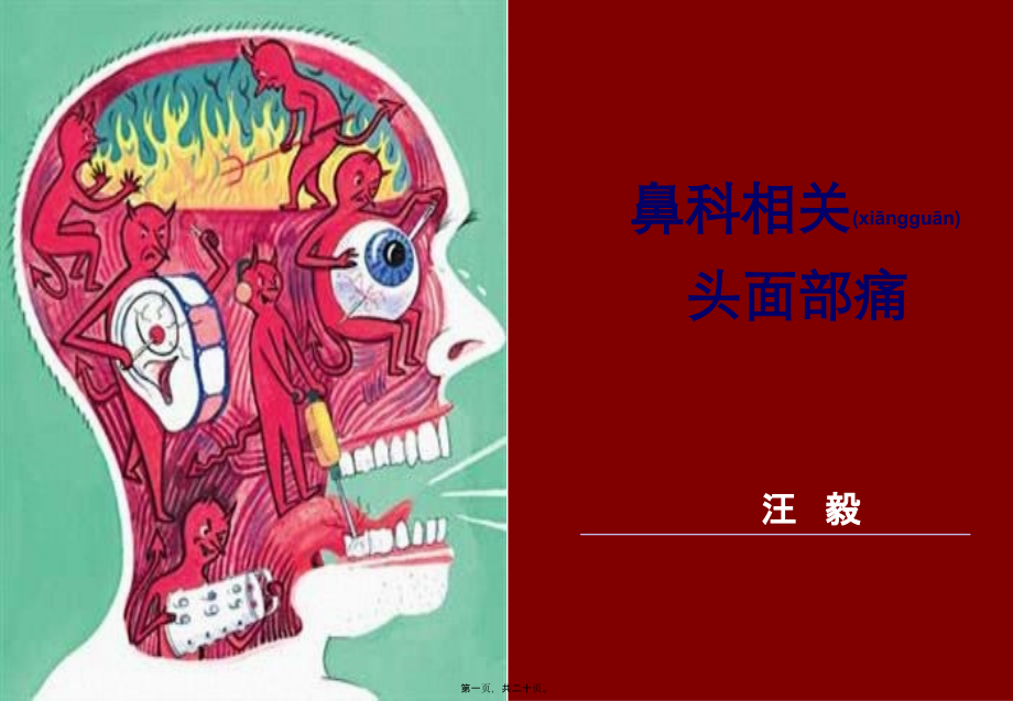 2022年医学专题—头痛与面部疼痛.ppt_第1页