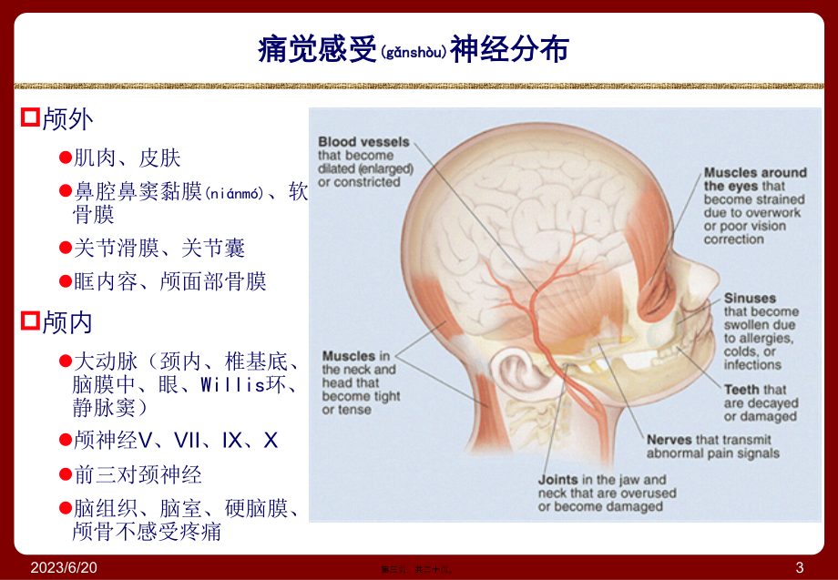 2022年医学专题—头痛与面部疼痛.ppt_第3页