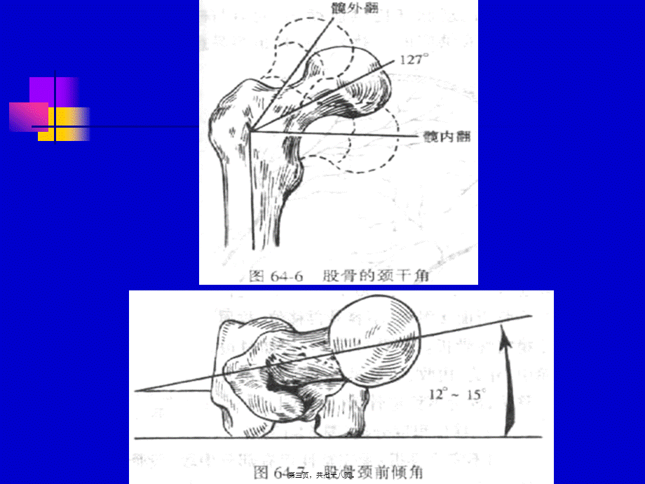 2022年医学专题—下肢骨折牵引图片2材料.ppt_第3页