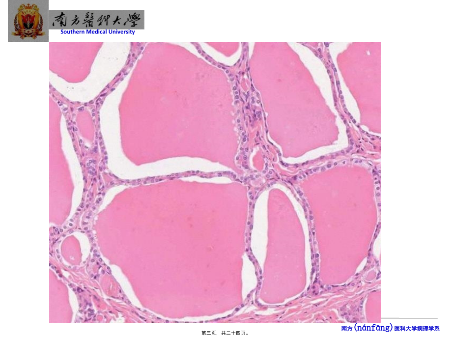 2022年医学专题—甲状腺.pptx_第3页