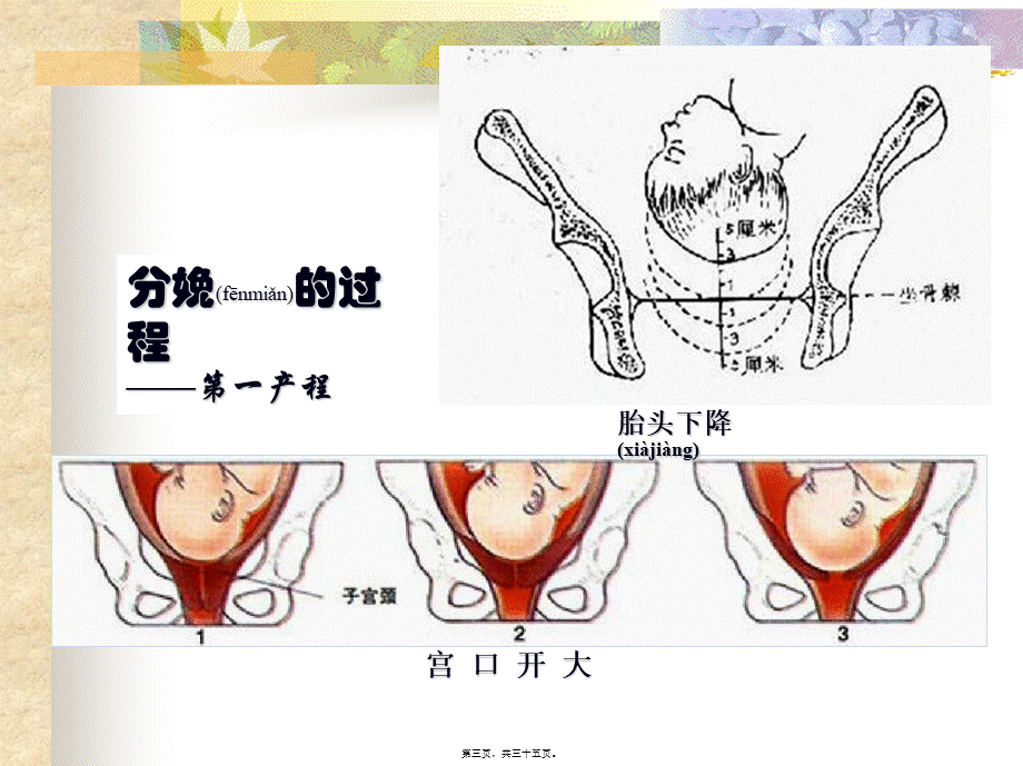 2022年医学专题—拉玛泽减痛分娩法(1).ppt_第3页