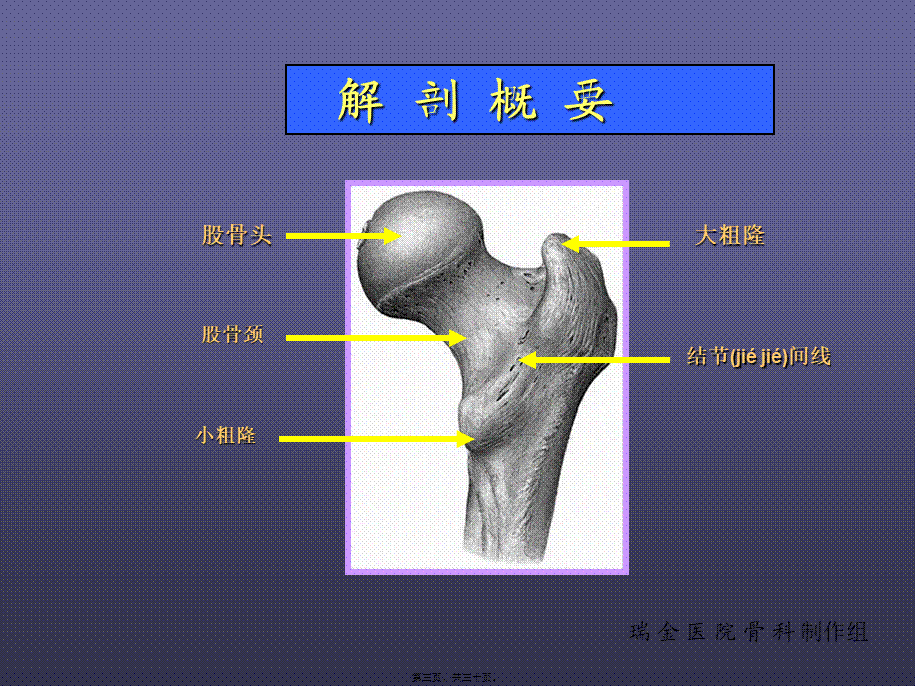 2022年医学专题—股骨颈骨折-PPT(1).ppt_第3页