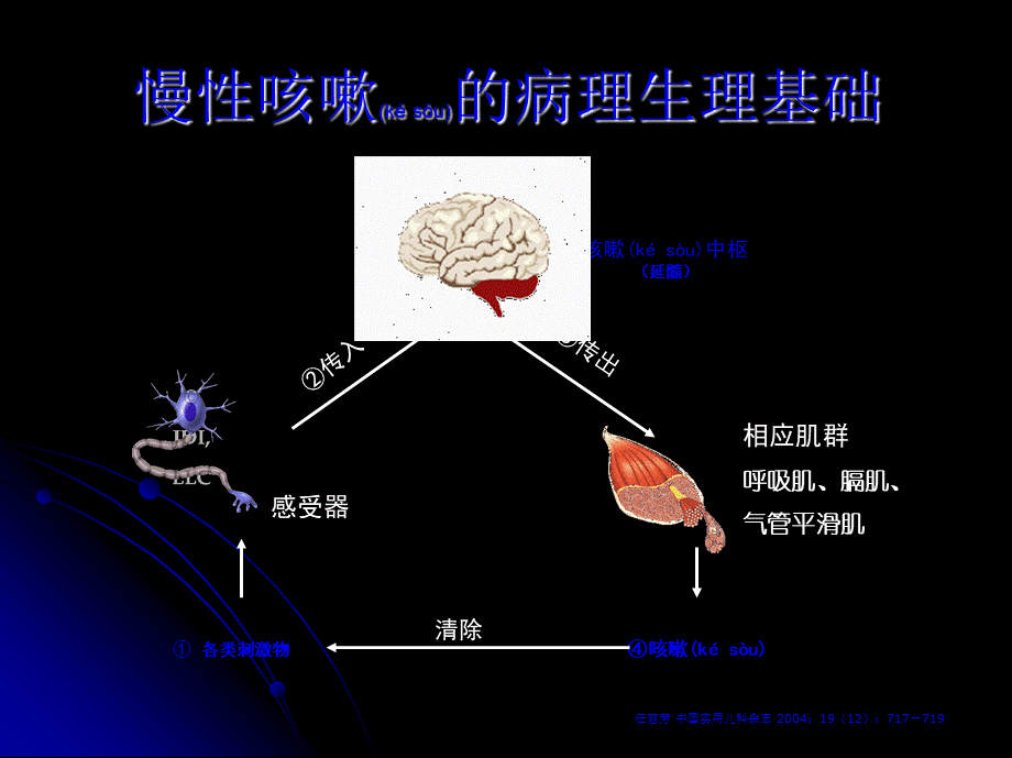 2022年医学专题—儿童-慢性咳嗽(1).ppt_第3页