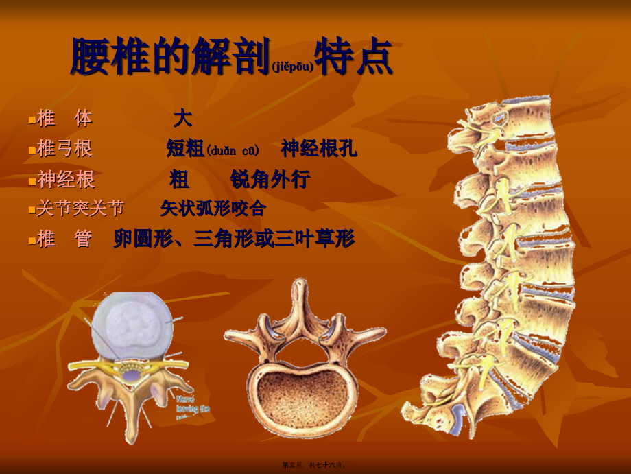 2022年医学专题—腰腿痛的诊治.ppt_第3页