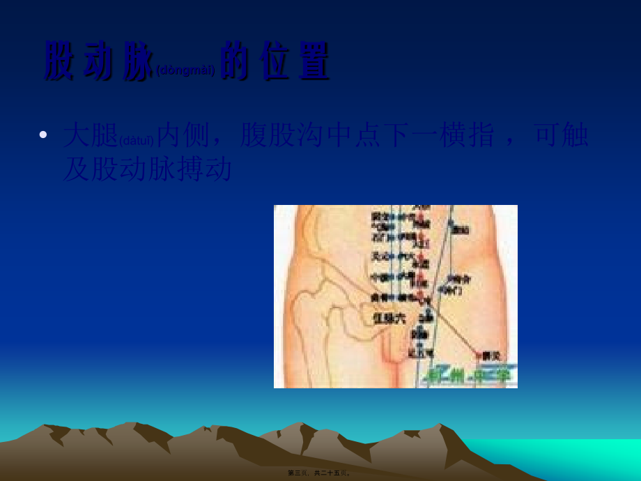 2022年医学专题—股动脉采血要点.ppt_第3页