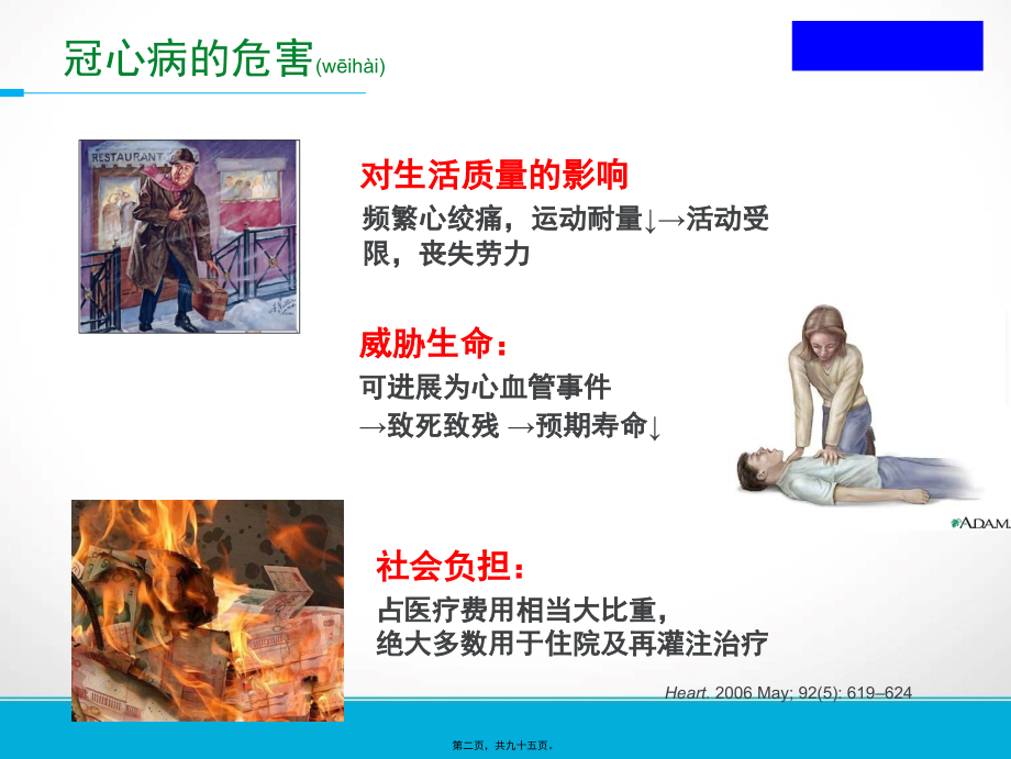 2022年医学专题—危重冠心病.ppt_第2页