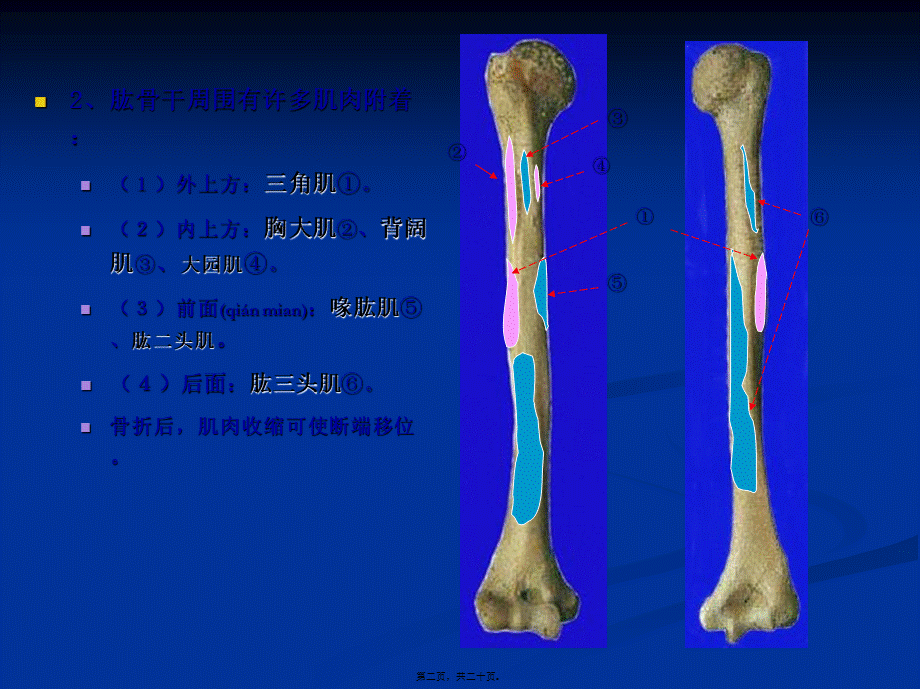 2022年医学专题—伤科肱骨干骨折(1).ppt_第2页