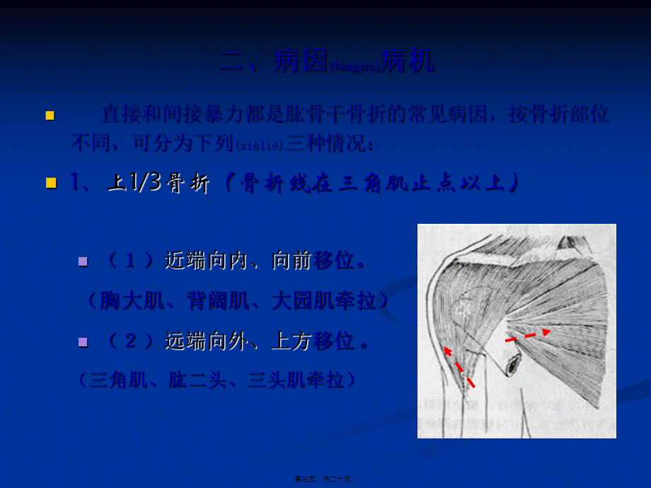 2022年医学专题—伤科肱骨干骨折(1).ppt_第3页