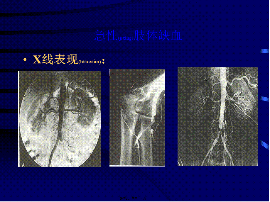 2022年医学专题—依诺肝素在血管外科的应用.ppt_第3页