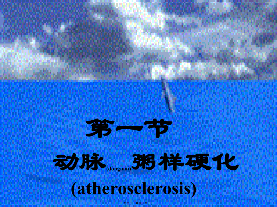 2022年医学专题—动脉粥样硬、冠心病.ppt_第3页