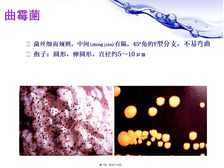 2022年医学专题—变应性支气管肺曲霉菌病ABPA(1).ppt_第1页