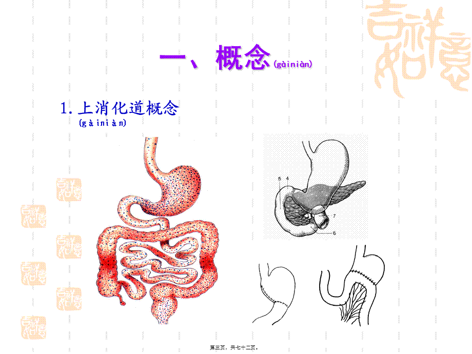 2022年医学专题—xxxttt上消化道出血(1).ppt_第3页