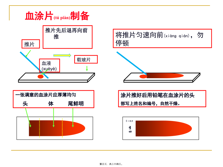 2022年医学专题—白细胞分类计数(1).ppt_第3页