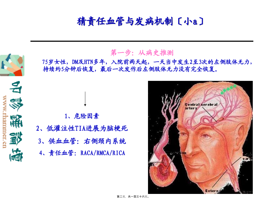 从影像学梗死部位推测责任供血血管.pptx_第2页