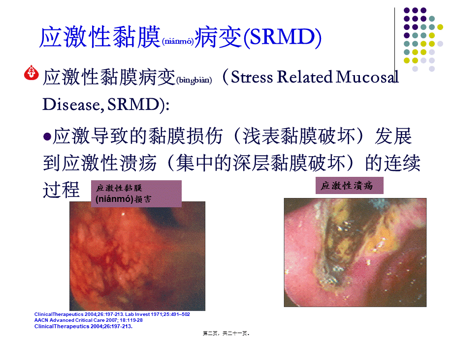 2022年医学专题—ICU中的应激性黏膜病变-(SRMD)pocketingslides(1).ppt_第2页