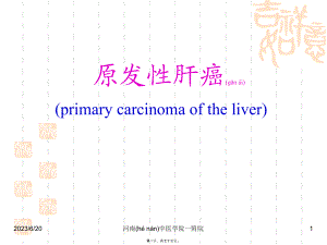 2022年医学专题—原发性肝癌(教学).ppt