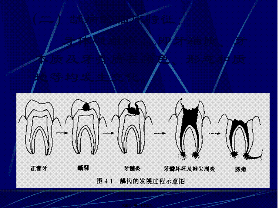 2022年医学专题—牙体牙髓病(1).ppt_第3页