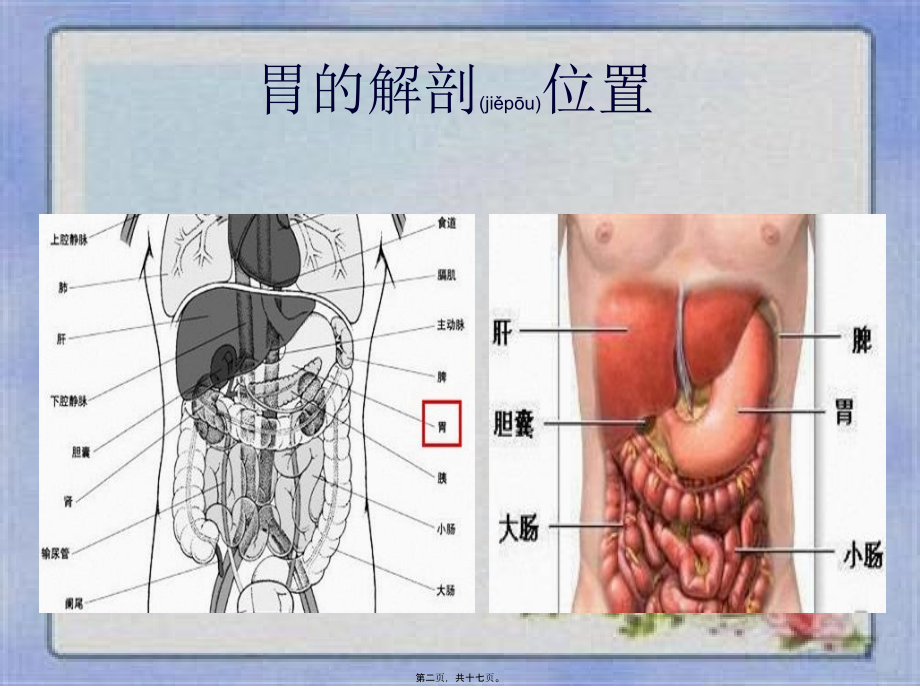 2022年医学专题—胃癌常见手术方式及术后并发症.ppt_第2页