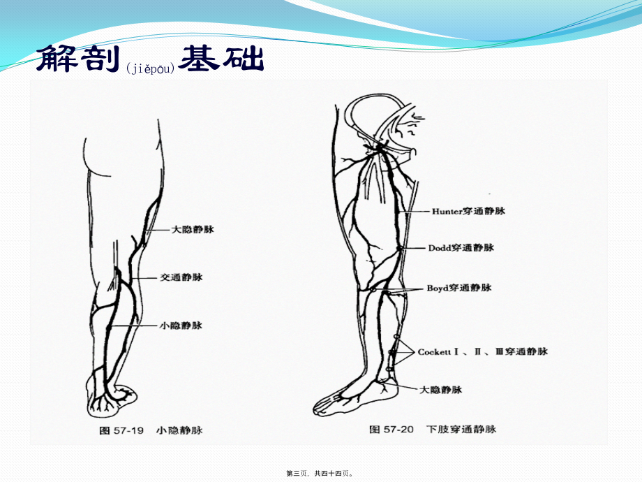 2022年医学专题—单纯性下肢静脉曲张(1).pptx_第3页