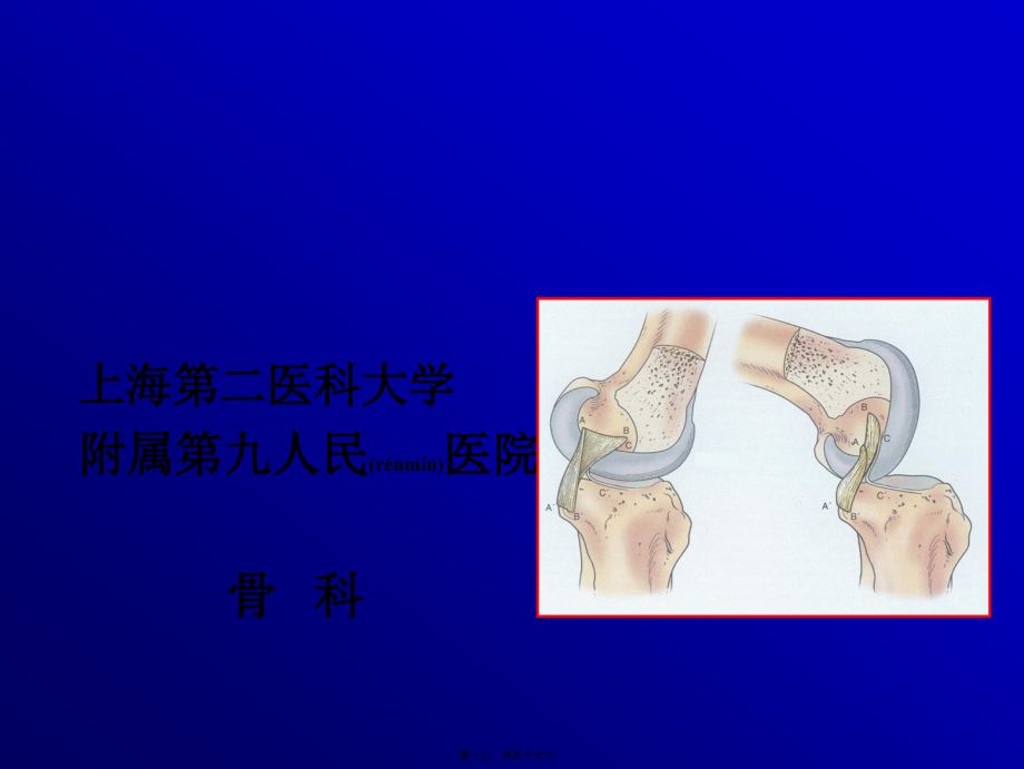 2022年医学专题—关节镜下的后交叉韧带重建术.ppt_第1页