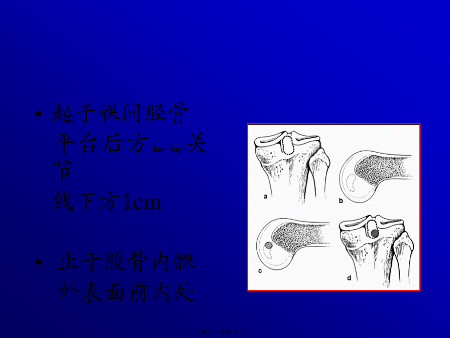 2022年医学专题—关节镜下的后交叉韧带重建术.ppt_第2页