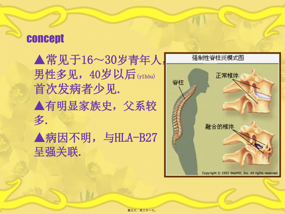 2022年医学专题—强直性脊柱炎1详解.ppt_第3页