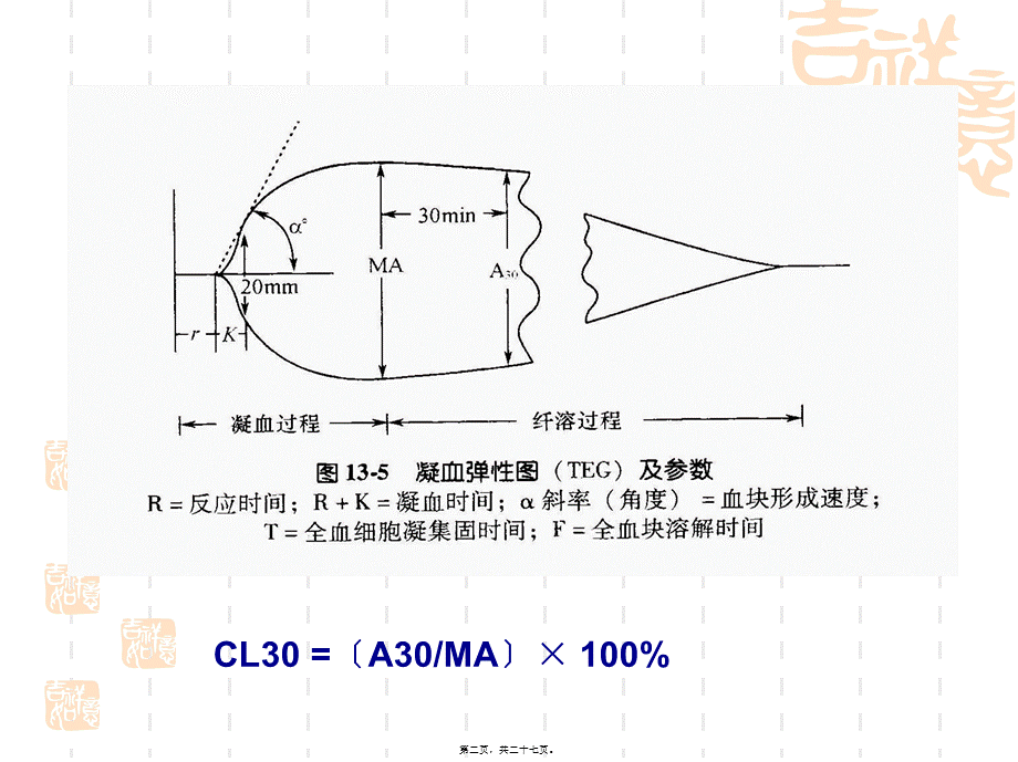 判定使用抗血小板药氯吡格雷.pptx_第2页