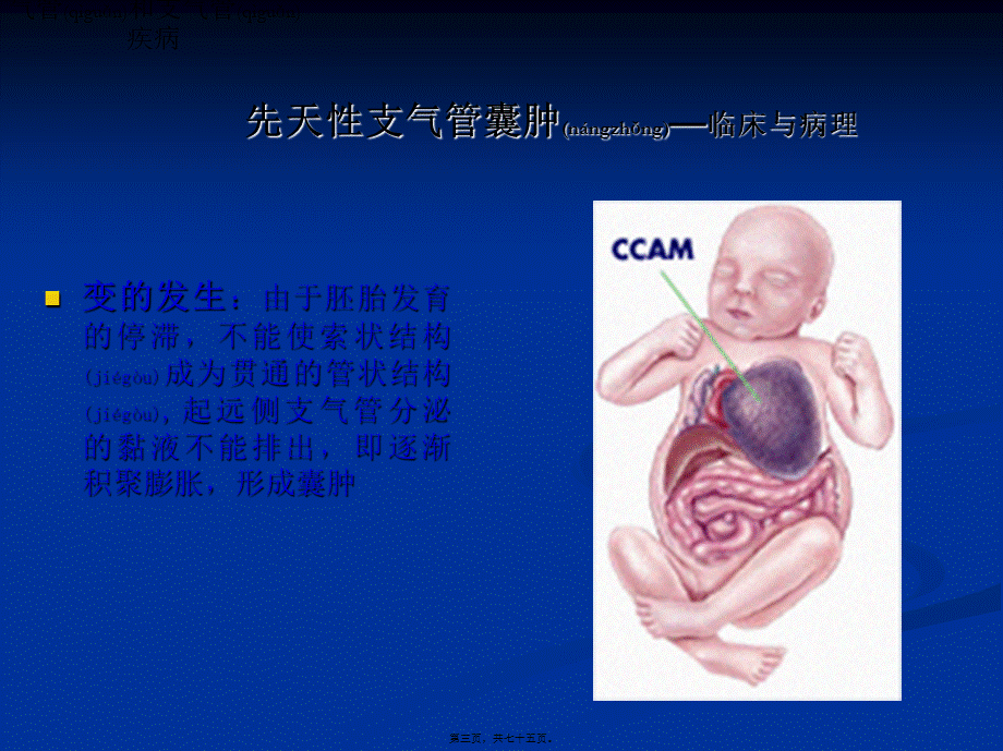 2022年医学专题—第6章-呼吸系统(1).ppt_第3页