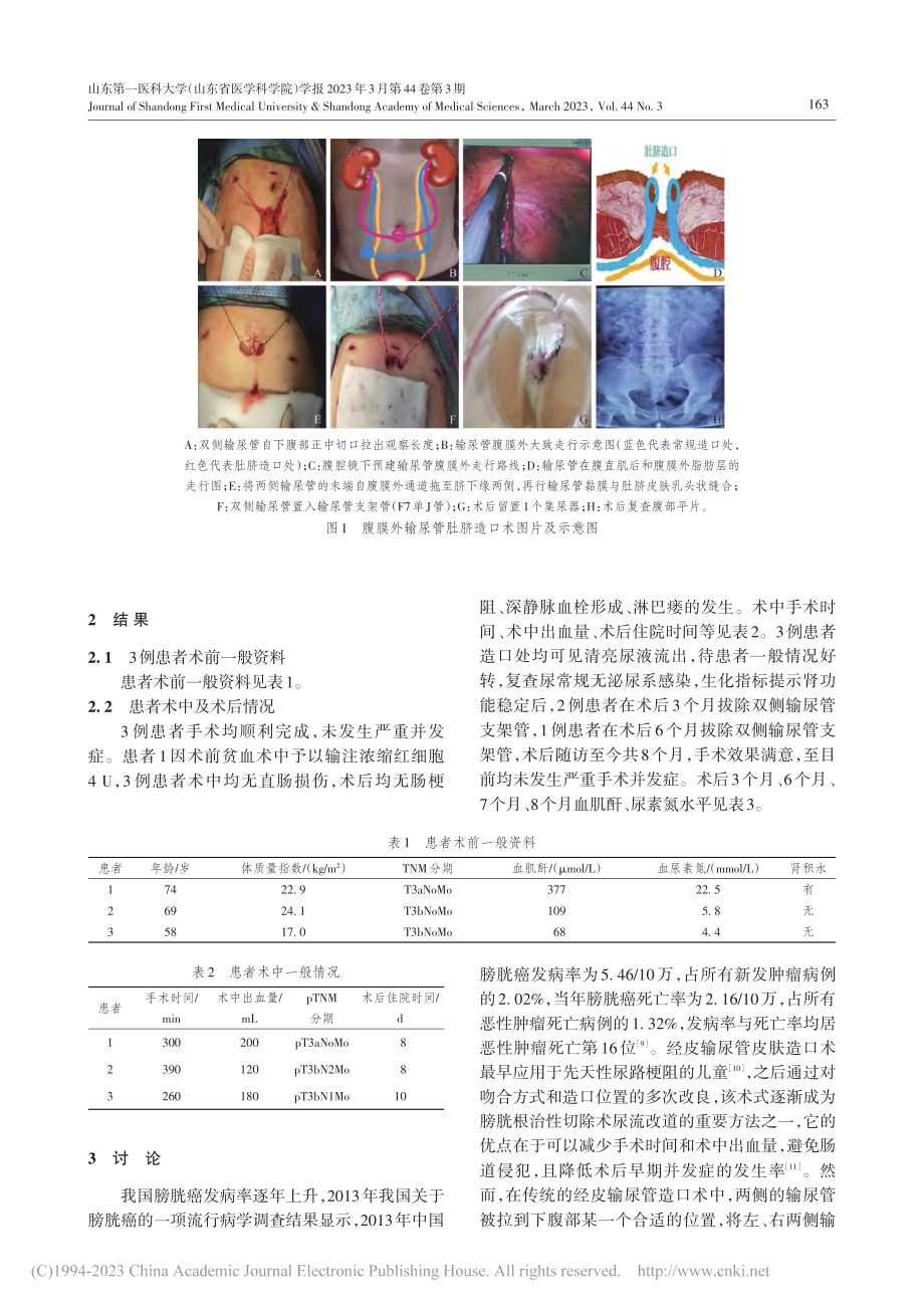 腹腔镜下膀胱根治性切除经腹膜外输尿管肚脐造口术_钟浩.pdf_第3页