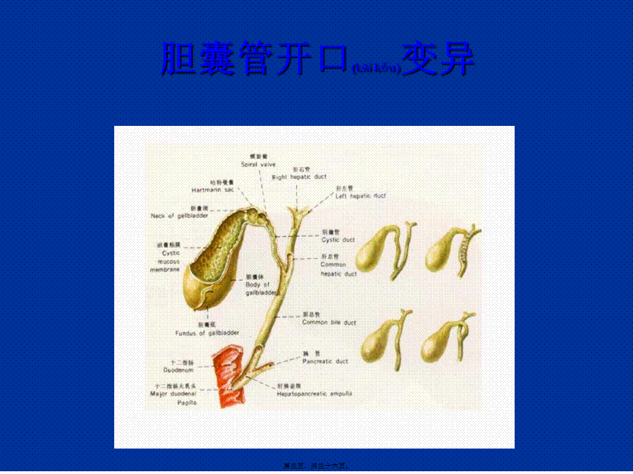 2022年医学专题—胆囊结石及防治(1).ppt_第3页