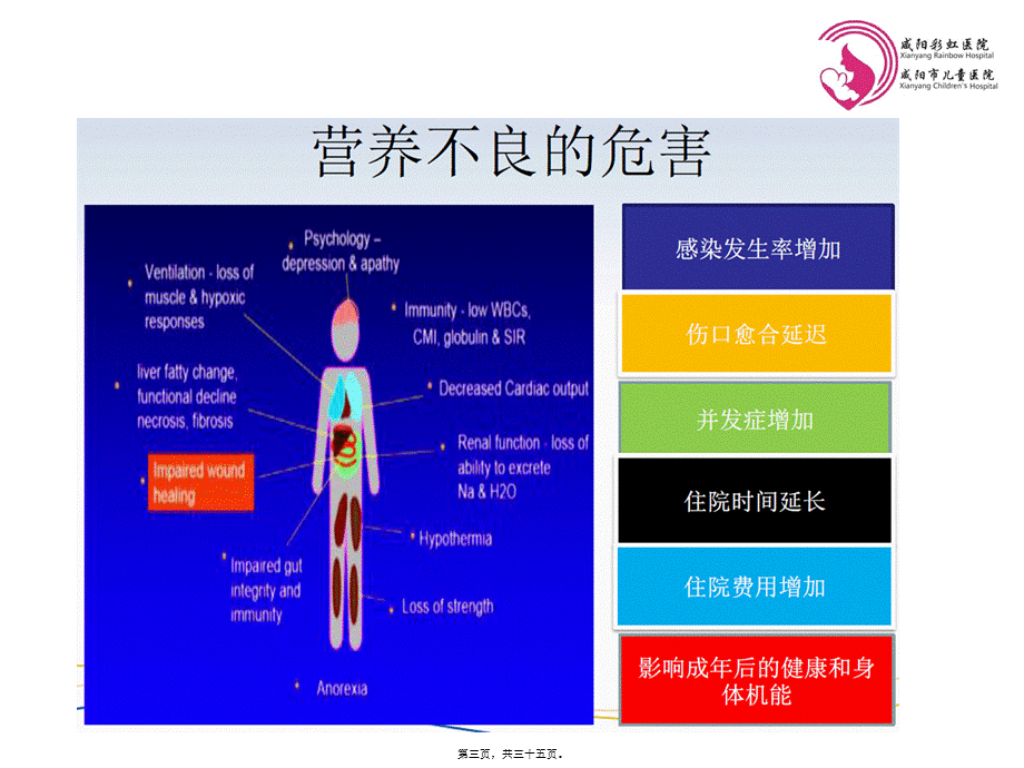 2022年医学专题—儿童营养评估及干预措施概述(1).ppt_第3页