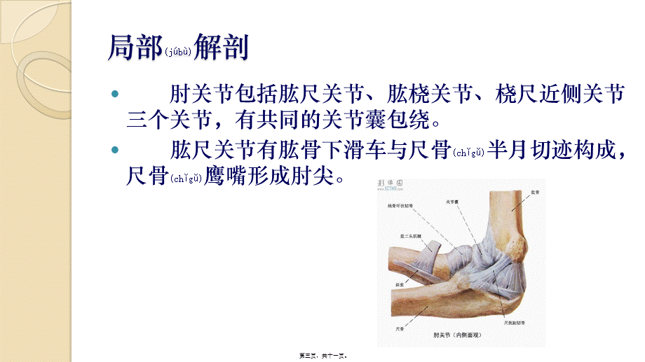 2022年医学专题—尺骨鹰嘴滑膜囊炎(1).pptx_第3页