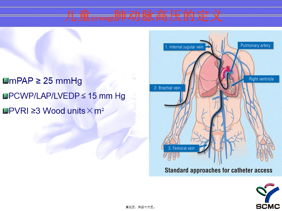 2022年医学专题—儿童肺动脉高压的特点2012(1).ppt_第3页