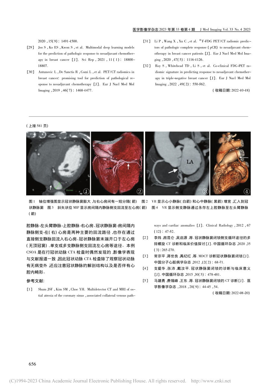 冠状静脉窦闭锁1例_石敏.pdf_第2页