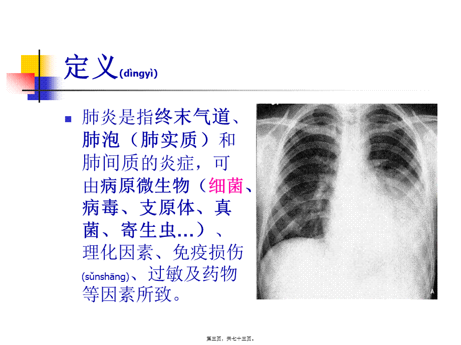 2022年医学专题—.肺炎概述(1).ppt_第3页