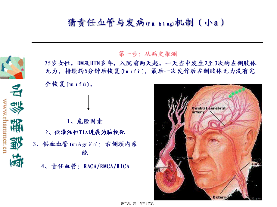 2022年医学专题—从影像学梗死部位推测责任供血血管(1).ppt_第2页